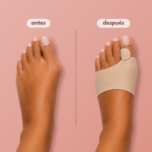 Corrector Ortopédico Pro-Fit™ para Juanetes